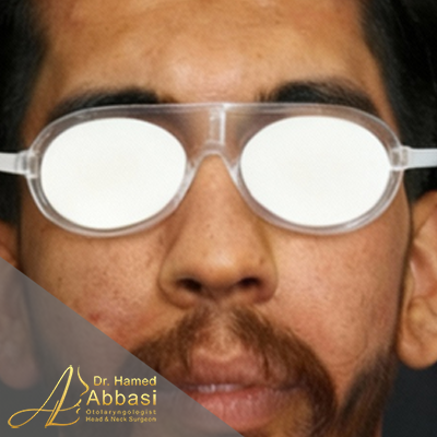 قبل