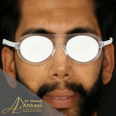 بعد