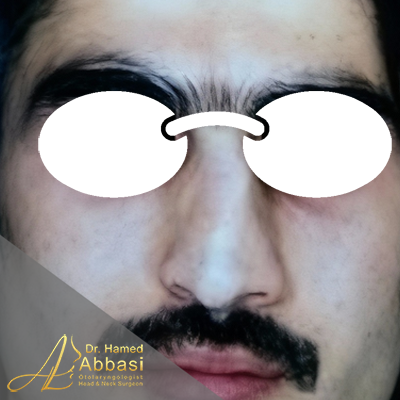 قبل