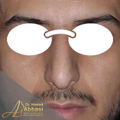 قبل