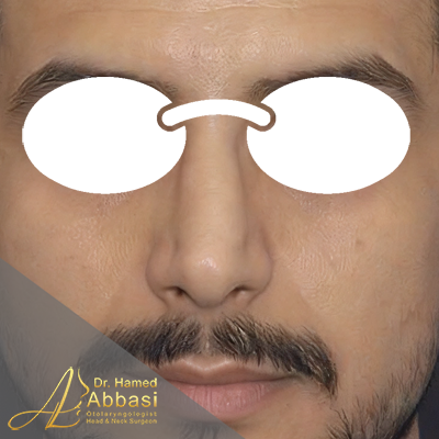 بعد