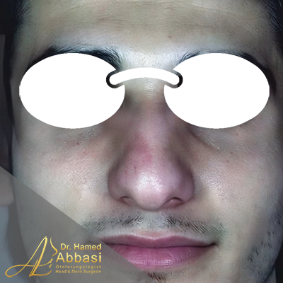قبل