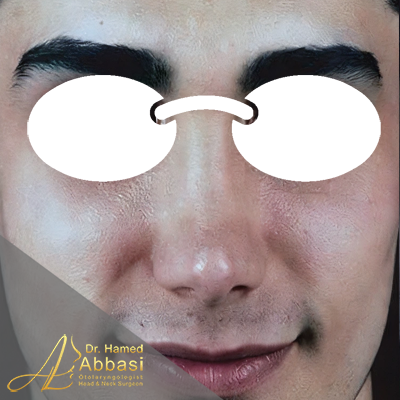 بعد