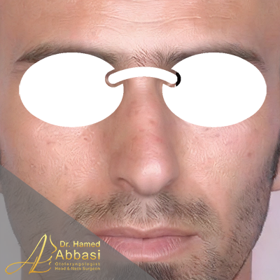 قبل