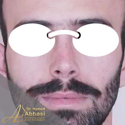 بعد