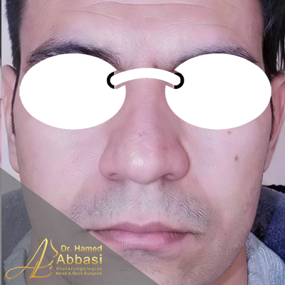 قبل