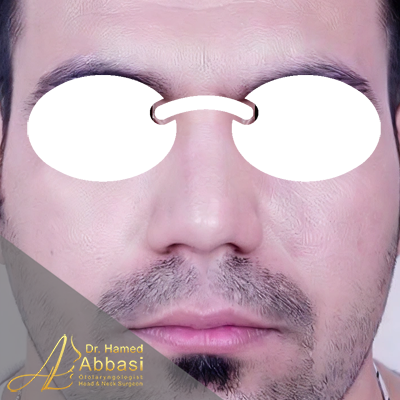 بعد