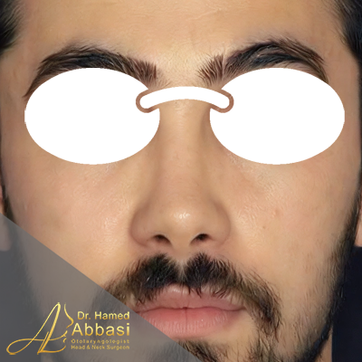 بعد