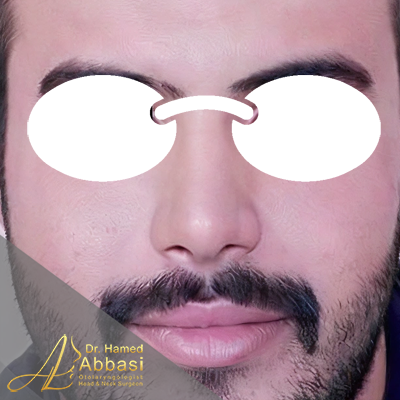 بعد