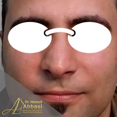 قبل