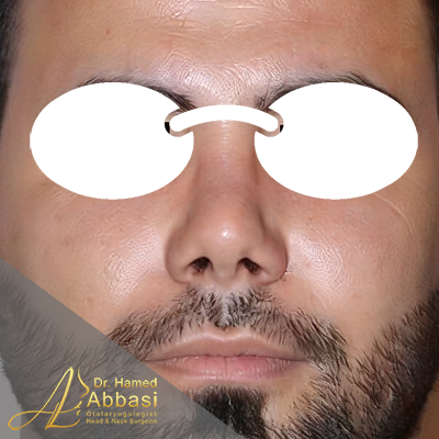 بعد