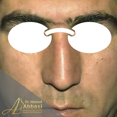 قبل