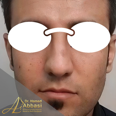 قبل