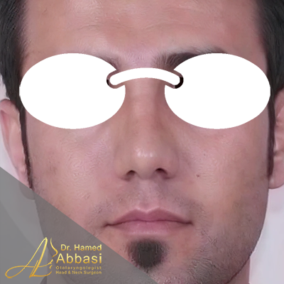 بعد