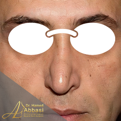 قبل