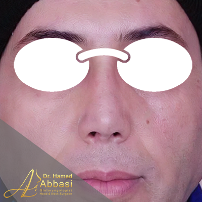 بعد