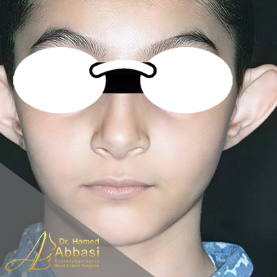 قبل