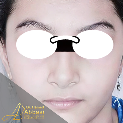 بعد