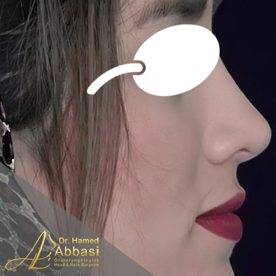 بعد