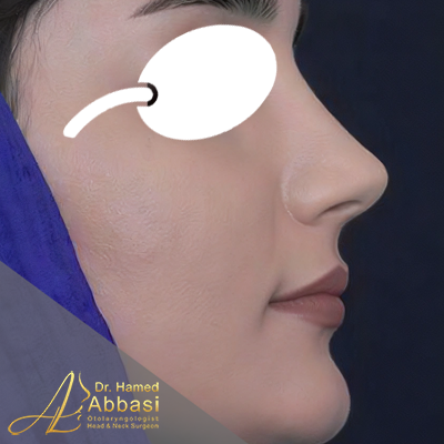 بعد