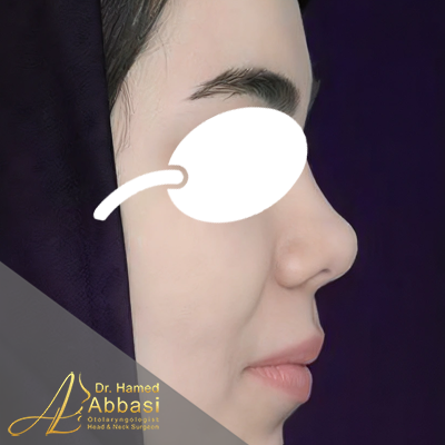 بعد