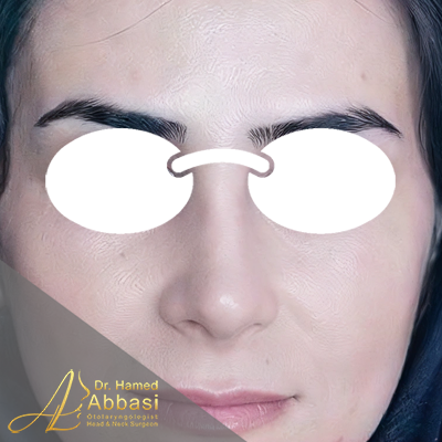 بعد