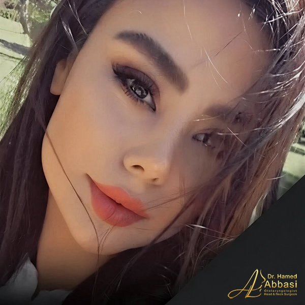 صور من جراحات الأنف للدكتور عباسي