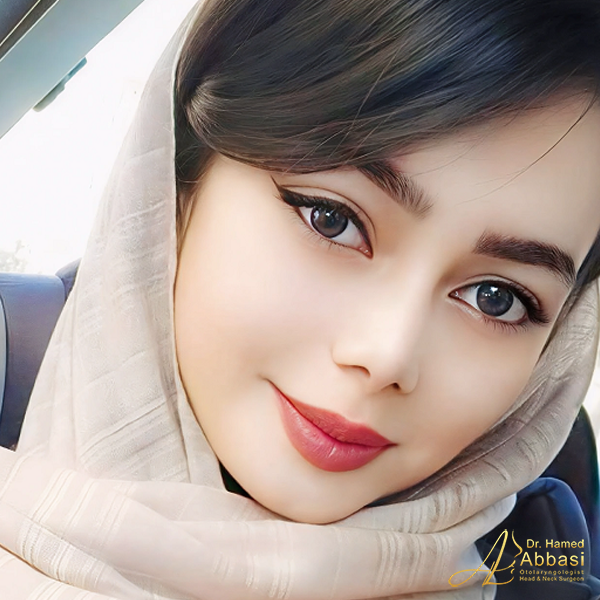 صور من جراحات الأنف للدكتور عباسي
