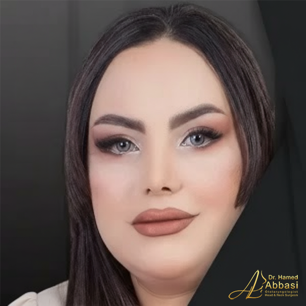 صور من جراحات الأنف للدكتور عباسي