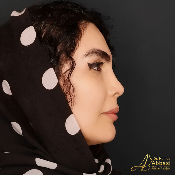 جراحة الأنف على يد الدكتور حامد عباسي