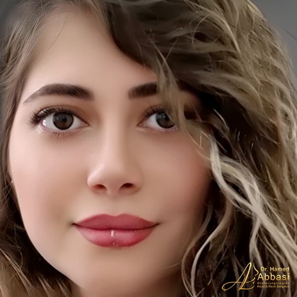 صور من جراحات الأنف للدكتور عباسي