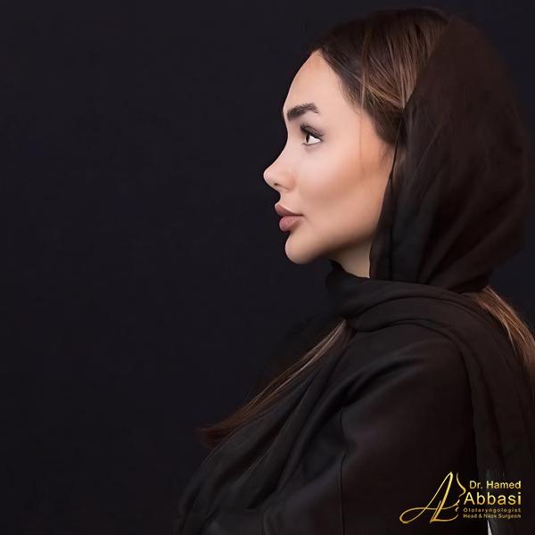 جراحة الأنف على يد الدكتور حامد عباسي