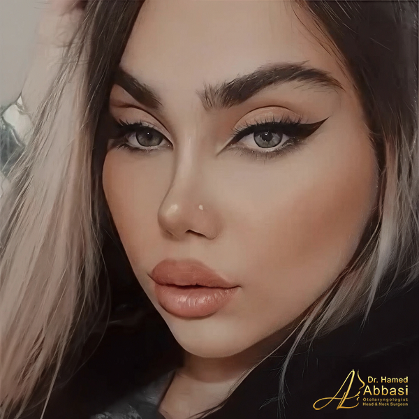 جراحة الأنف على يد الدكتور حامد عباسي