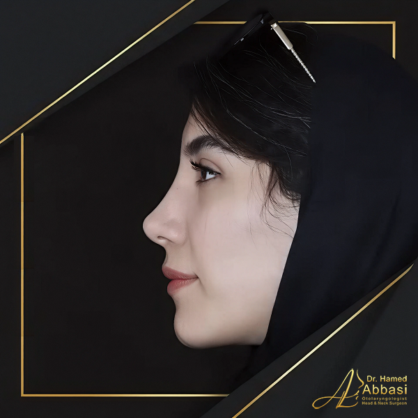 صور من جراحات الأنف للدكتور عباسي
