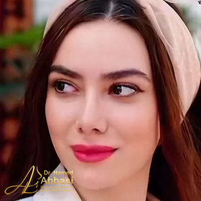 صور عمليات تجميل الأنف للدكتور عباسي