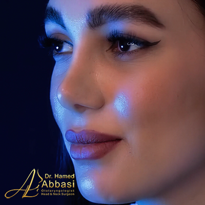 صور عمليات تجميل الأنف للدكتور عباسي