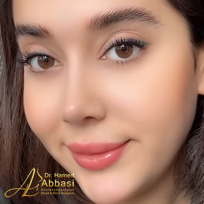 صور عمليات تجميل الأنف للدكتور عباسي