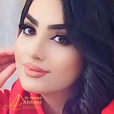 صور عمليات تجميل الأنف للدكتور عباسي