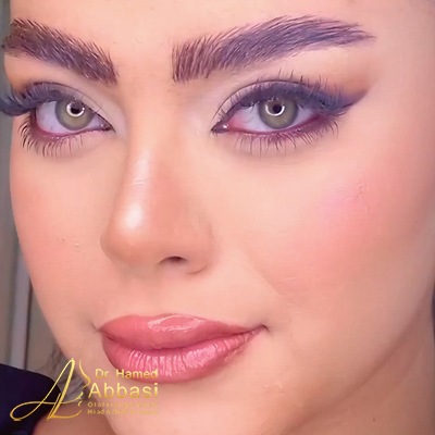صور عمليات تجميل الأنف للدكتور عباسي