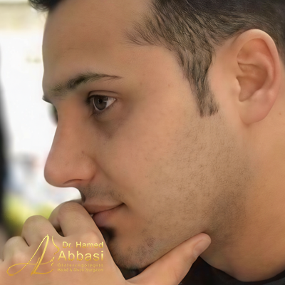 صور عمليات تجميل الأنف للدكتور عباسي