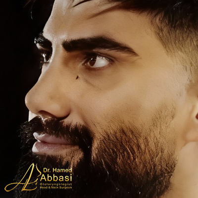 صور عمليات تجميل الأنف للدكتور عباسي